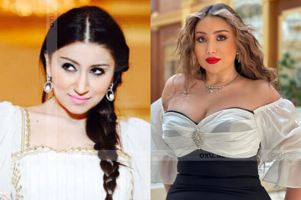 Gözəlliyi ilə diqqət çəkən azərbaycanlı məşhurların əməliyyatdan öncəki görüntüləri - FOTO