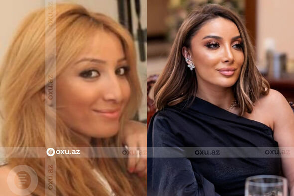 Gözəlliyi ilə diqqət çəkən azərbaycanlı məşhurların əməliyyatdan öncəki görüntüləri - FOTO