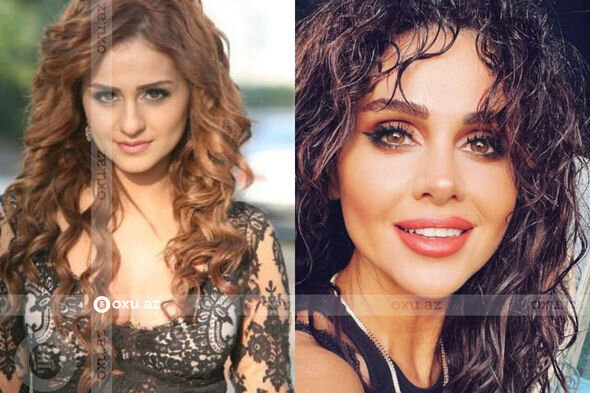 Gözəlliyi ilə diqqət çəkən azərbaycanlı məşhurların əməliyyatdan öncəki görüntüləri - FOTO