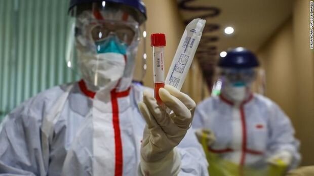 ÜST 31,3 milyard dollar istəyir: Koronavirus testi, müalicəsi və peyvəndi üçün