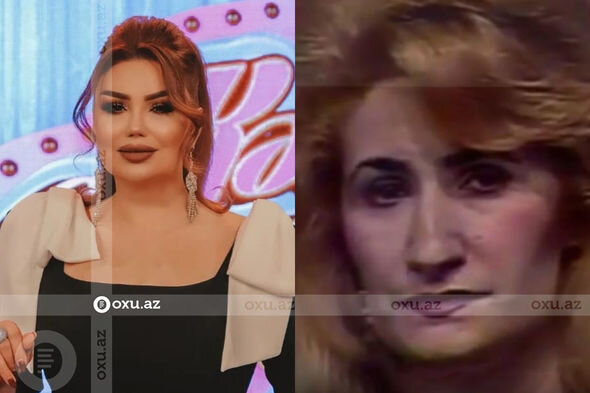 Gözəlliyi ilə diqqət çəkən azərbaycanlı məşhurların əməliyyatdan öncəki görüntüləri - FOTO