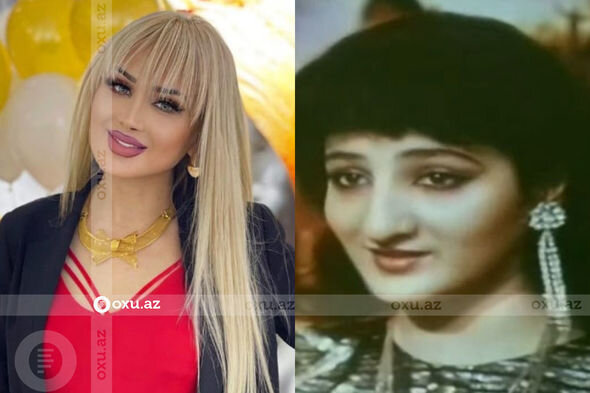 Gözəlliyi ilə diqqət çəkən azərbaycanlı məşhurların əməliyyatdan öncəki görüntüləri - FOTO