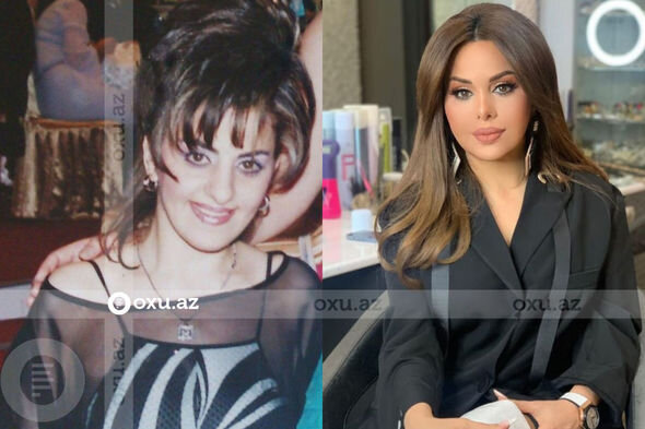 Gözəlliyi ilə diqqət çəkən azərbaycanlı məşhurların əməliyyatdan öncəki görüntüləri - FOTO