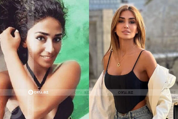 Gözəlliyi ilə diqqət çəkən azərbaycanlı məşhurların əməliyyatdan öncəki görüntüləri - FOTO