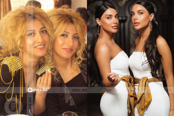 Gözəlliyi ilə diqqət çəkən azərbaycanlı məşhurların əməliyyatdan öncəki görüntüləri - FOTO