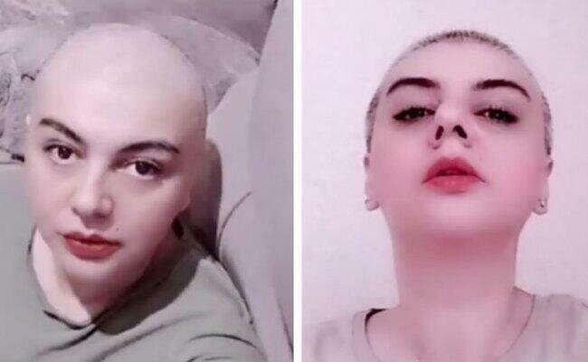 Saçını keçəl edən "Banu"nun Günelindən YENİ FOTO