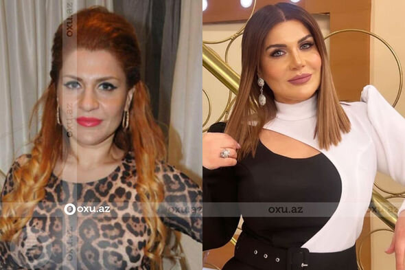 Gözəlliyi ilə diqqət çəkən azərbaycanlı məşhurların əməliyyatdan öncəki görüntüləri - FOTO