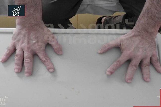 Saakaşvili tanınmaz halda - FOTOLAR