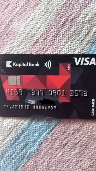 Yeddi yaşlı Aytən təcili əməliyyat olunmalıdır - FOTO