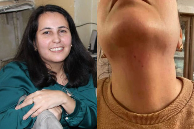 Jurnalist Aytən Məmmədovaya hücumla bağlı cinayət işi başlanılıb