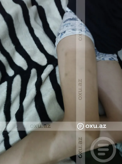 Bakıda məktəbli sinif yoldaşı tərəfindən döyüldü: Kamera niyə işləməyib? - İDDİA - FOTO