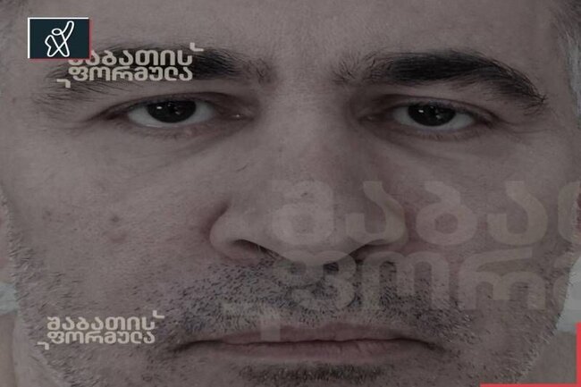 Saakaşvili tanınmaz halda - FOTOLAR