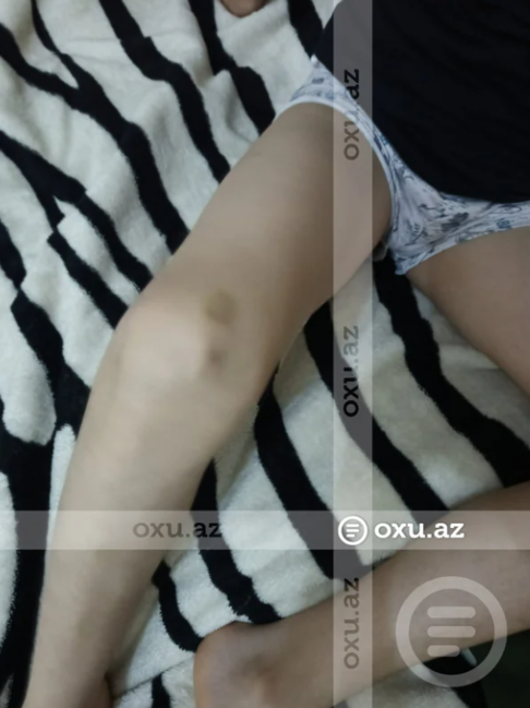 Bakıda məktəbli sinif yoldaşı tərəfindən döyüldü: Kamera niyə işləməyib? - İDDİA - FOTO