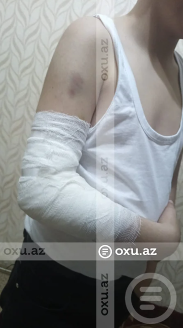 Bakıda məktəbli sinif yoldaşı tərəfindən döyüldü: Kamera niyə işləməyib? - İDDİA - FOTO