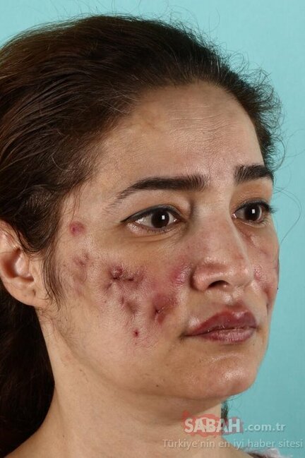 Plastik əməliyyat edən qadın tanınmaz hala düşdü - DƏHŞƏTLİ FOTOLAR