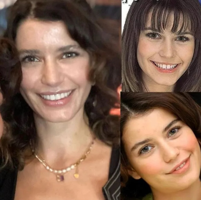 Beren Saat reklam üçün dişlərini düzəltdirdi, bəyənilmədi - Foto