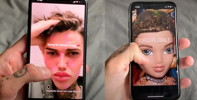Oğlan "İnstagram"ın filtr effekti kimi görünmək üçün ƏMƏLİYYAT ETDİRDİ - FOTO-VİDEO