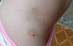 Novxanıda 6 yaşlı uşağı restoranda it dişləyib