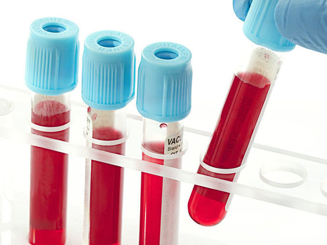 Qan qrupunun insanların həyatına 7 MÜHÜM TƏSİRİ