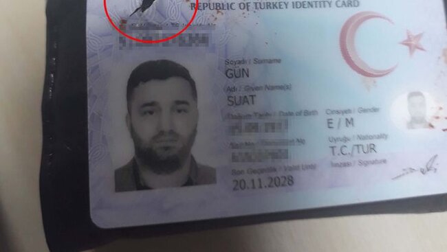 Cibindəki pul kisəsi baxın nəyə səbəb oldu? - fotolar