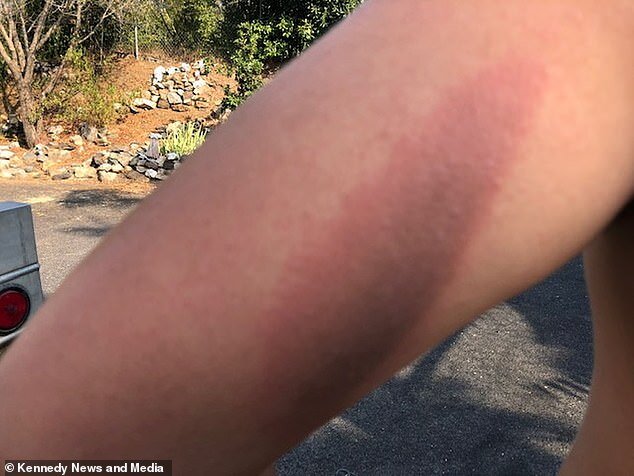 Telefonu şarja qoyub yuxuya gedən yeniyetmə BELƏ YANDI - FOTO+18