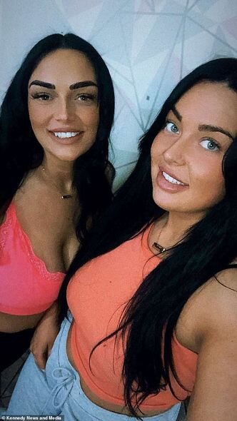 "TikTok"dakı üsulla yumurta bişirməyə çalışan qadının bütün üzü yandı - FOTO/VİDEO