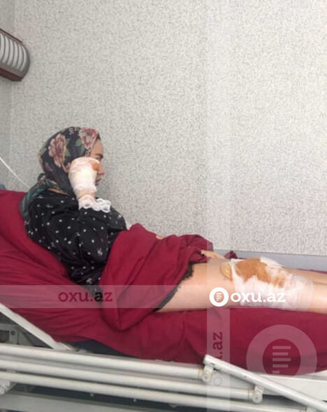 Gecə klubunda xəsarət alan modelin görüntüləri – FOTO