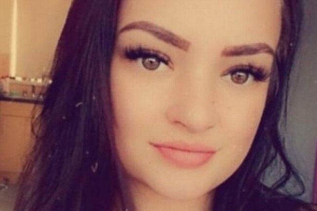 25 yaşlı qızı iti parçalayıb yedi - FOTO