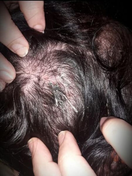 15 yaşında ərə verilən qız həyat yoldaşı və qayınanası tərəfindən döyülüb - FOTOLAR