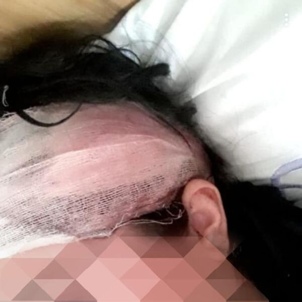 15 yaşında ərə verilən qız həyat yoldaşı və qayınanası tərəfindən döyülüb - FOTOLAR