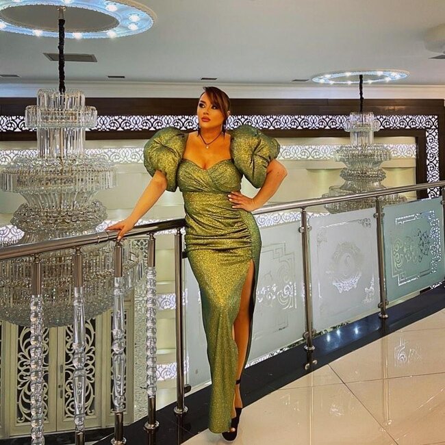 Xatirə plastik əməliyyatdan sonra belə görünür - FOTO