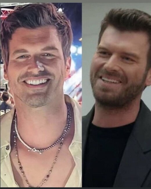 Kıvançın yeni görünüşü bəyənilmədi - FOTO