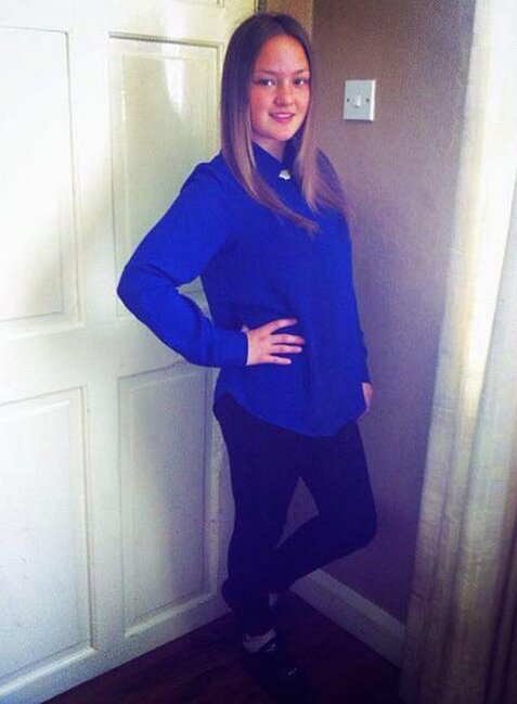 25 yaşlı qızı iti parçalayıb yedi - FOTO