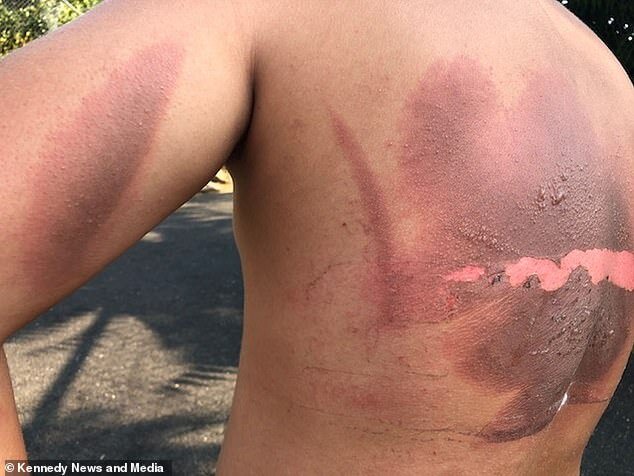 Telefonu şarja qoyub yuxuya gedən yeniyetmə BELƏ YANDI - FOTO+18