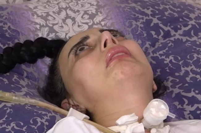 Bakıda rinoplastika əməliyyatından sonra iflic olan 34 yaşlı qadın öldü (FOTO)
