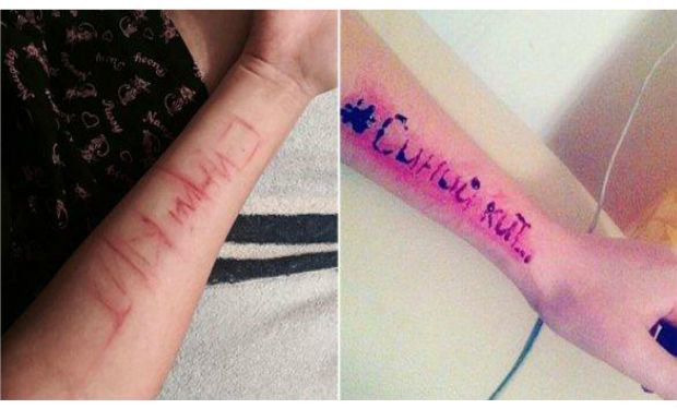 Hövsanda uşaqlar qollarını niyə kəsib? - Məktəbdən açıqlama