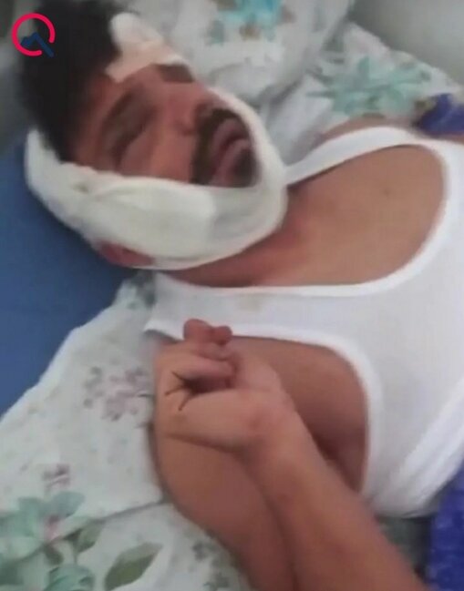 Partlayışda ağır xəsarət alan çempionun xəstəxanadan FOTOSU