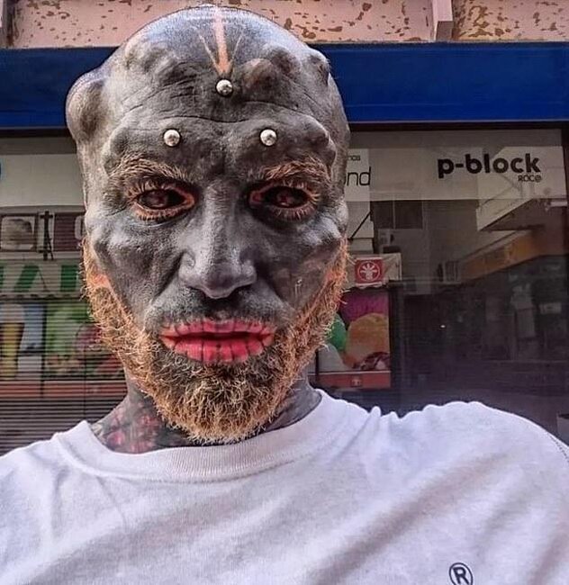 Yadplanetliyə oxşamaq üçün burnunu və dodaqlarını kəsdirdi, indi danışa bilmir - FOTO