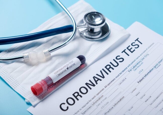 Koronavirusa qarşı mübarizə gücləndirilir