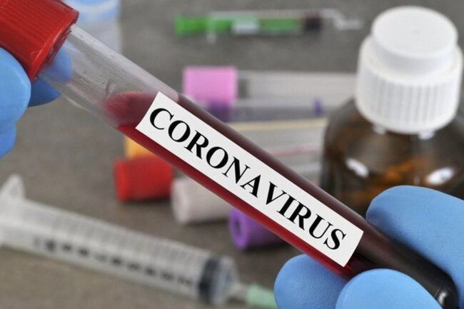 Tanınmış məşqçi yenidən koronavirusa yoluxdu