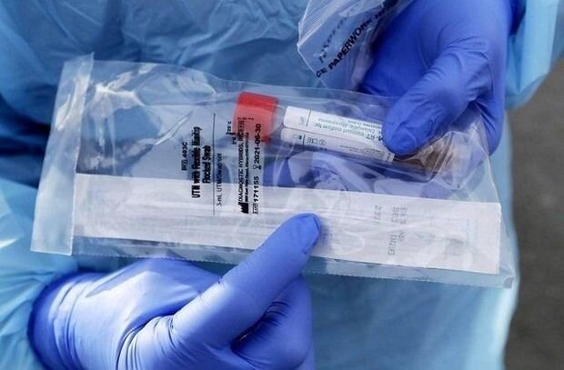 Azərbaycanda daha üç nəfər koronavirusdan öldü: 84 yeni yoluxma