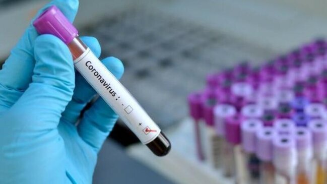 PCR diaqnostikası üçün 50-dən çox laboratoriya işə salındı