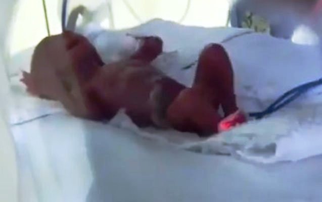 Bakıda çəkisi 370 qram olan uşaq doğuldu – Ailəsi istəmədi (VİDEO)