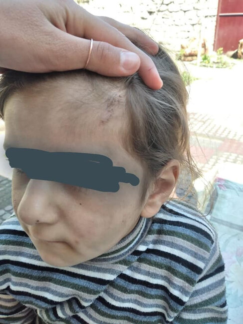 Azərbaycan ailəsində daha bir DƏHŞƏT: Atası döyür, anası isə...