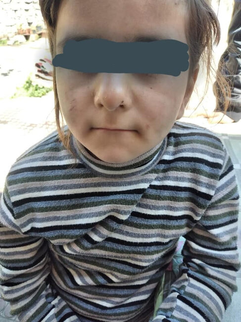 Azərbaycan ailəsində daha bir DƏHŞƏT: Atası döyür, anası isə...