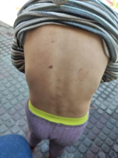 Azərbaycan ailəsində daha bir DƏHŞƏT: Atası döyür, anası isə...