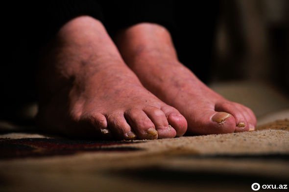 Səkkiz aylıq hamilə olan 20 yaşlı gəlini meşədə... - Xocalının izləri FOTOLARDA