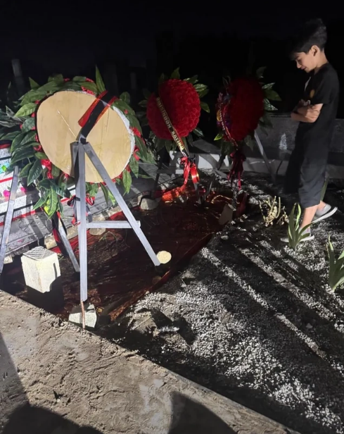 Bakıda rinoplastika əməliyyatından sonra iflic olan 34 yaşlı qadın öldü (FOTO)