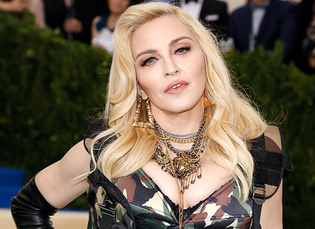 33 yaşlı kişi Madonnaya bənzəmək üçün 18 dəfə əməliyyata girdi – FOTO