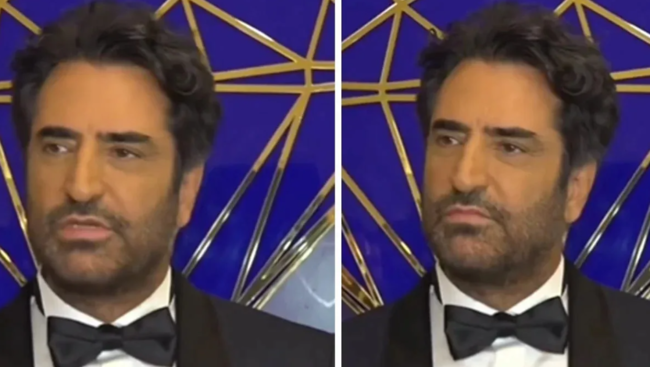 Mahsun Kırmızıgül botoks etdirib? - Foto